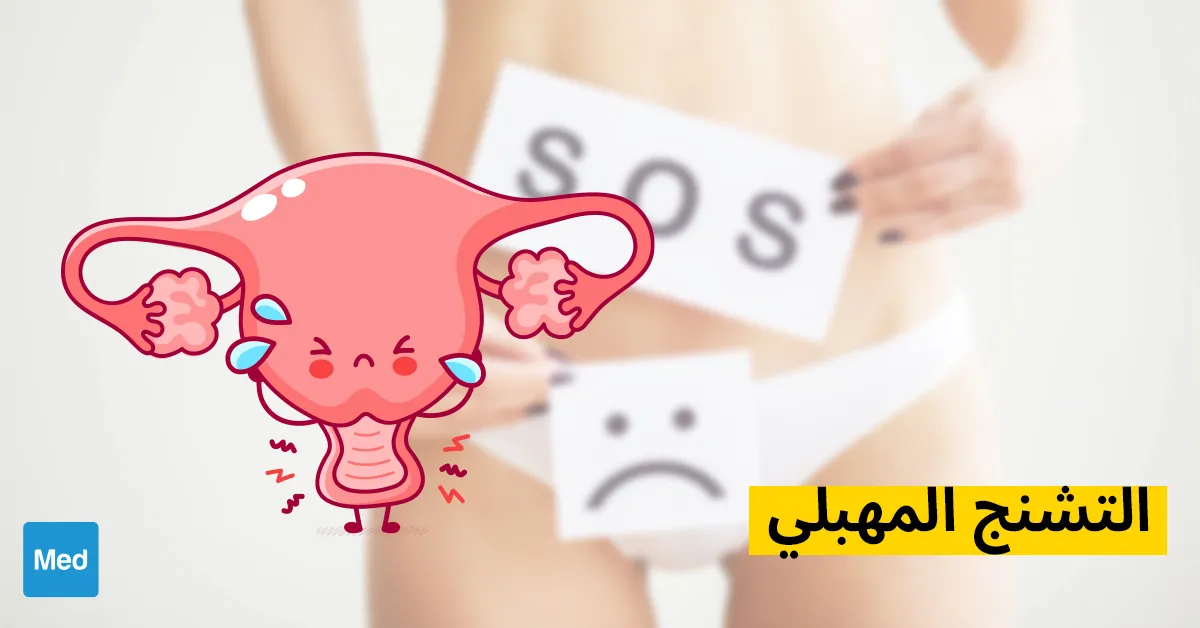 التشنج المهبلي